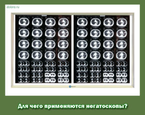 Для чего применяются негатоскопы?