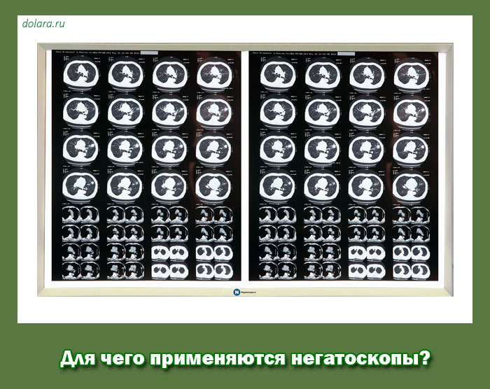 Для чего применяются негатоскопы?