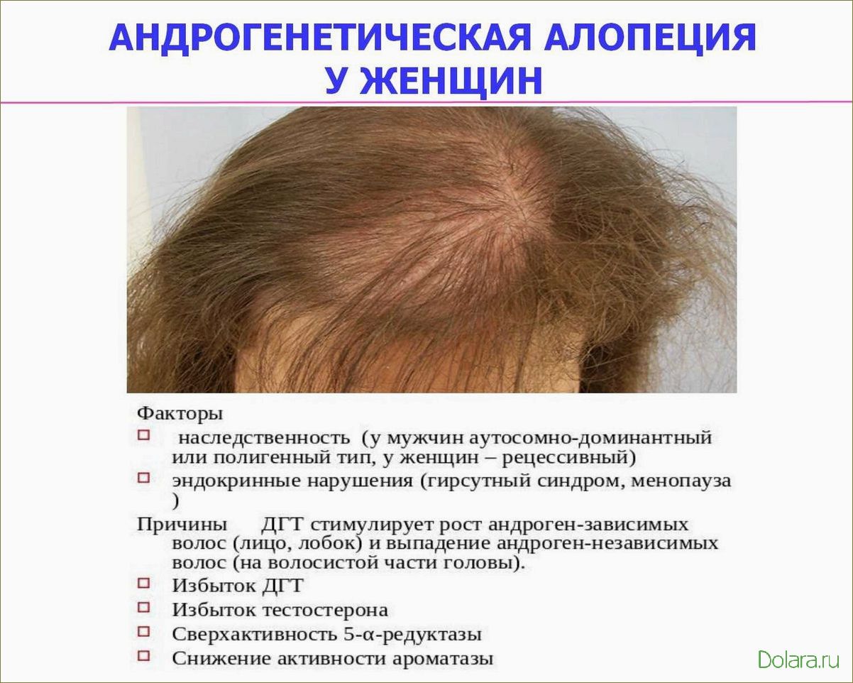 Причины выпадения волос
