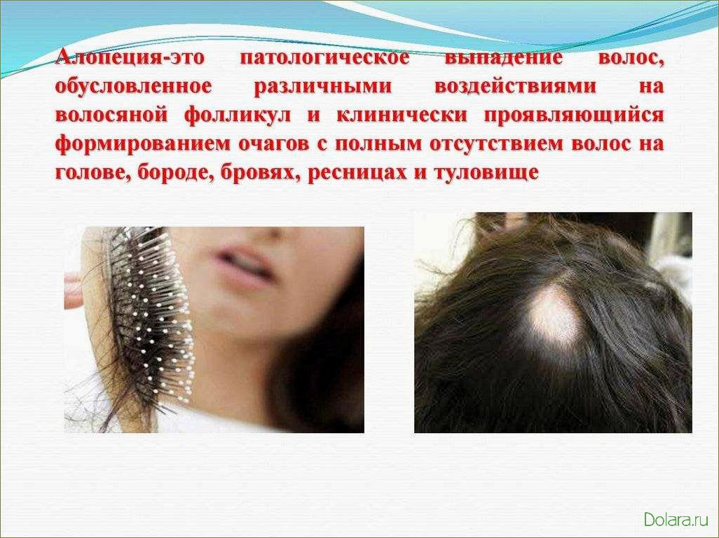Причины выпадения волос