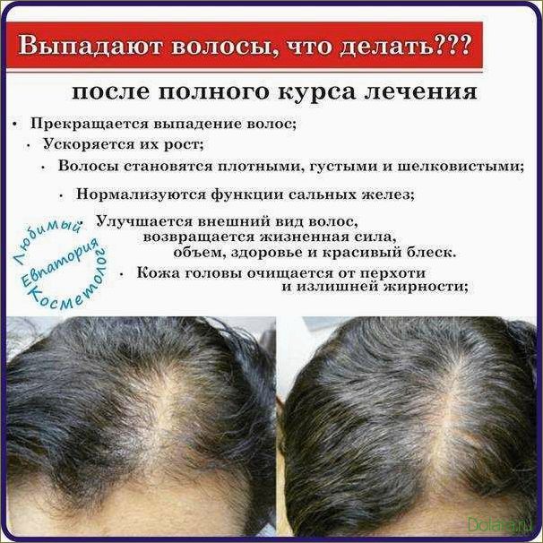 Причины выпадения волос
